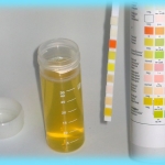 Как избавиться от белка в моче при беременности
