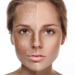 Как улучшить состояние кожи лица в домашних условиях??